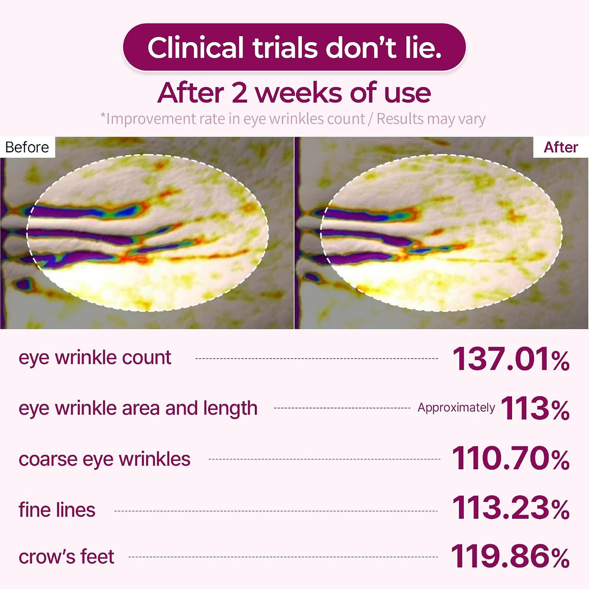 An infographic-style before-and-after comparison for eye wrinkles, with two oval close-ups labeled Before and After, plus text stating 'Clinical trials don't lie. After 2 weeks of use' and a list of measured improvements such as eye wrinkle count, area and length, coarse eye wrinkles, fine lines, and crow's feet.